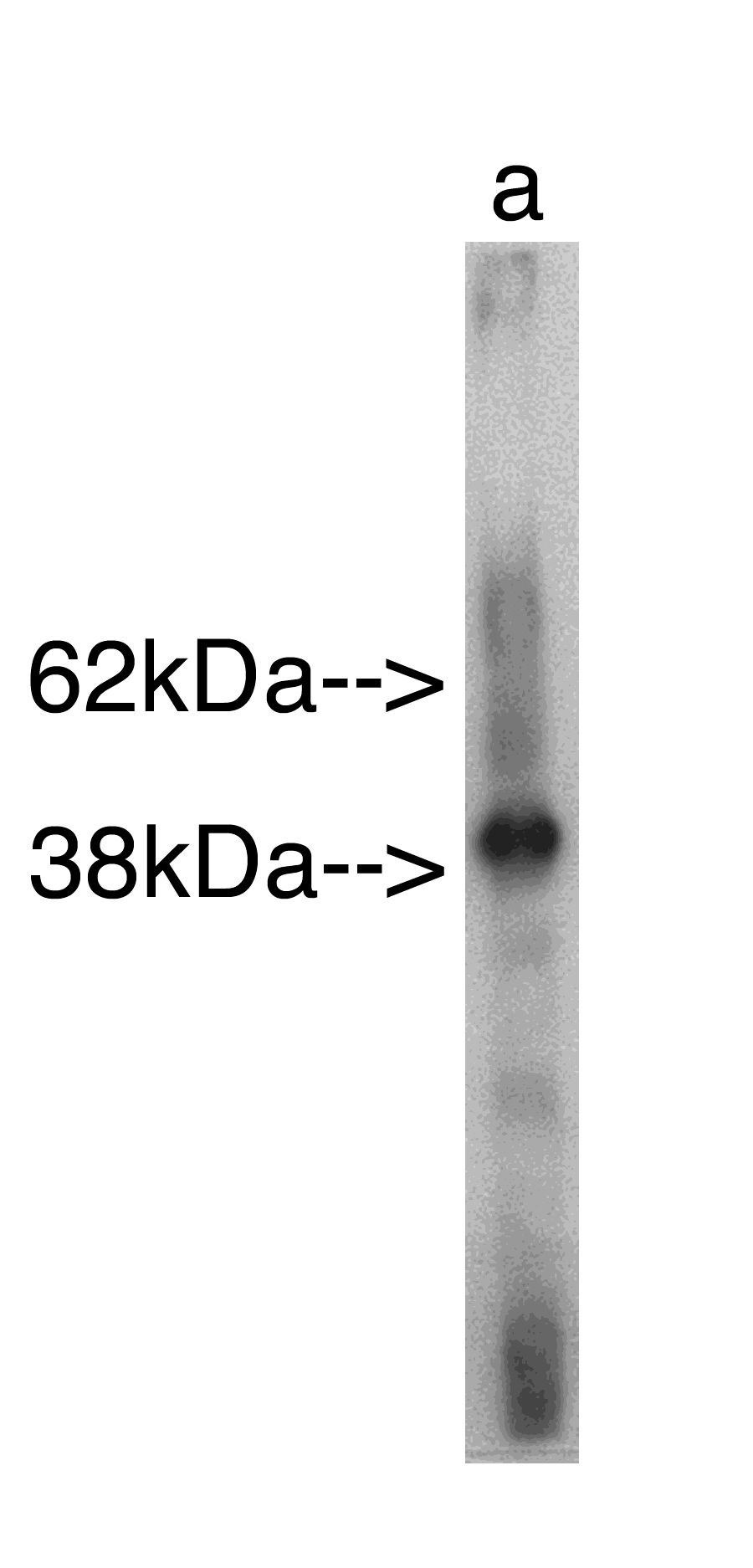 "
Western blot analysis using Sphingomyelin Synthase r (Cat. # X1704P) on recombinant protein Lane A] antibody alone. Anti Rabbit secondary used at 1:25K Exposure for 30 seconds

"